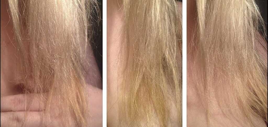 Аллергия на краску для волос