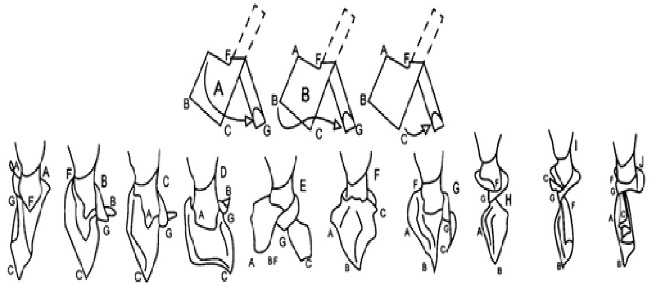 Французская косынка (88 фото), способы завязывания и как сшить своими руками мастер-класс