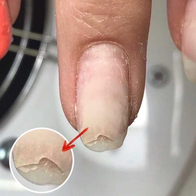 Как восстановить ногти после гель лака в домашних условиях