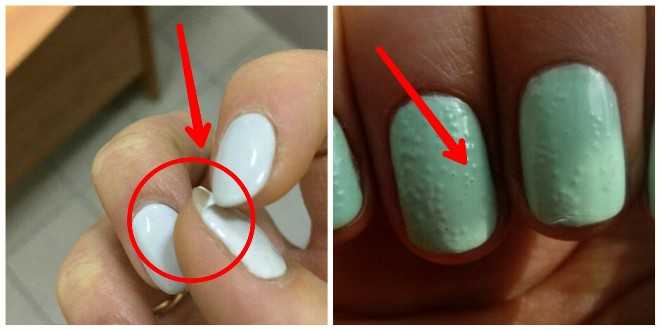 Почему пузырится лак на ногтях: что делать, как убрать и как избежать? как выбрать хороший лак для ногтей?