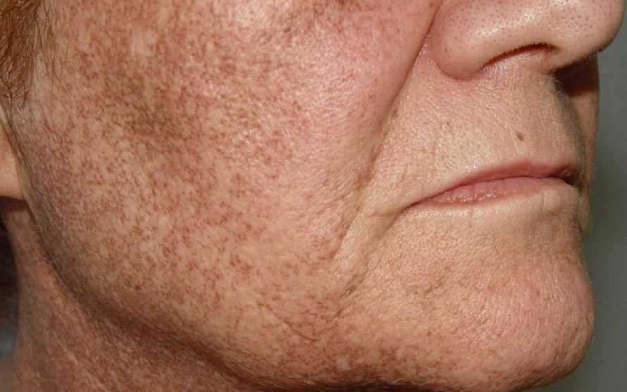 Как улучшить цвет лица. как изменить состояние кожи на лице в домашних условиях