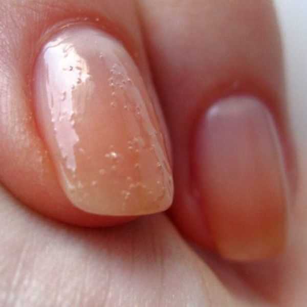 Почему лак на ногтях пузырится, как это исправить