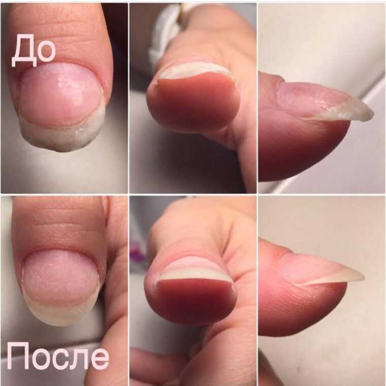 Восстановление ногтей после гель лака - это не работает!