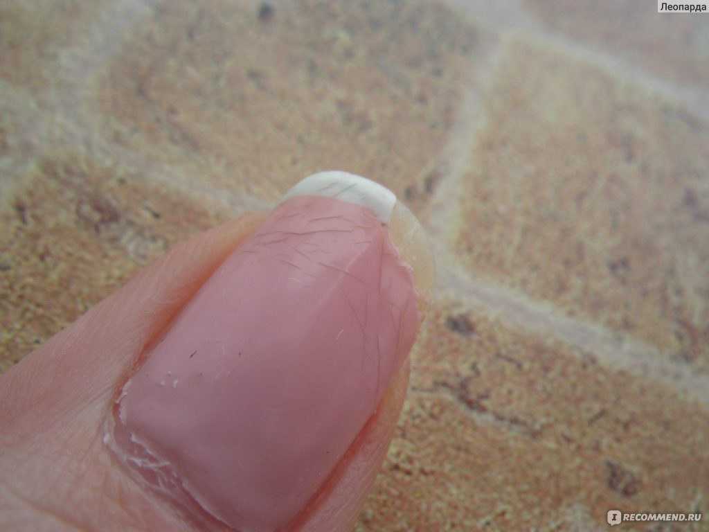 Гель-лак под кутикулу: особенности покрытия, пошаговая техника нанесения, секреты покраски ногтей, почему затекает
