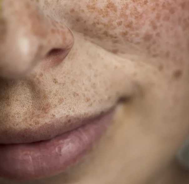 Средство для выравнивания кожи лица возвращает идеальный тон, борется с шелушениями, раздражениями и покраснениями Для создания ровного тона используются кремы, маски и салонные процедуры