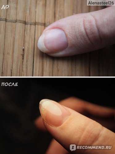 Каучуковая база для ногтей: что это за покрытие, как нанести и снять в домашних условиях